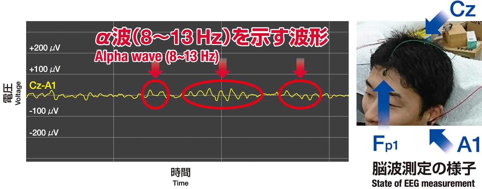 脳波測定の様子